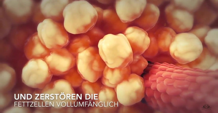 Wie funktioniert die Kavitation?